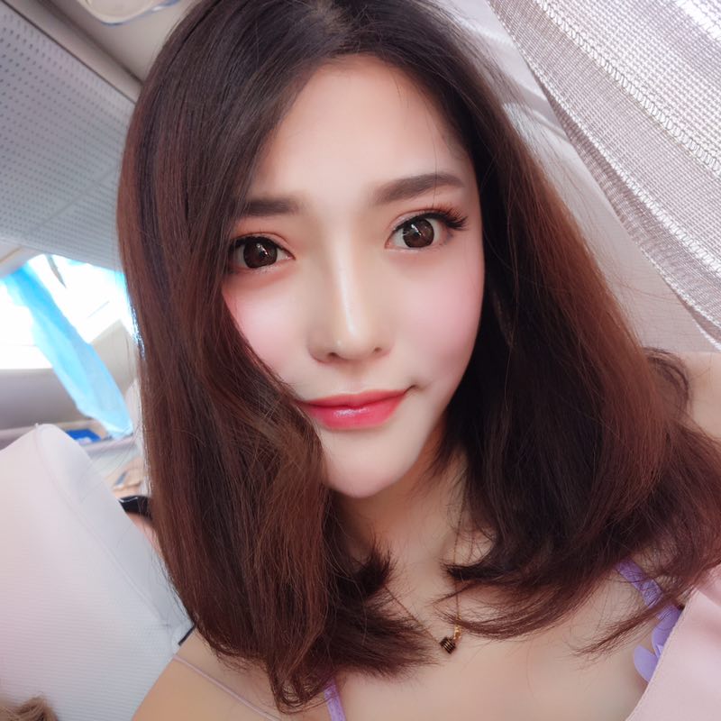 鄭州童一顏整形醫(yī)生李永勝做假體隆鼻+耳軟骨隆鼻案例效果對比圖