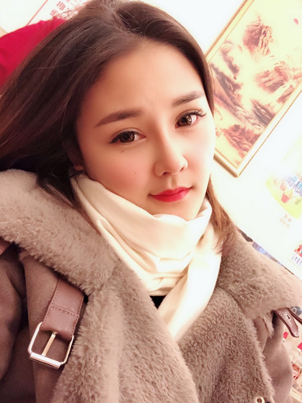 鄭州華領(lǐng)醫(yī)療美容醫(yī)院賀小虎醫(yī)生做眼綜合+鼻部整形手術(shù)效果怎么樣？