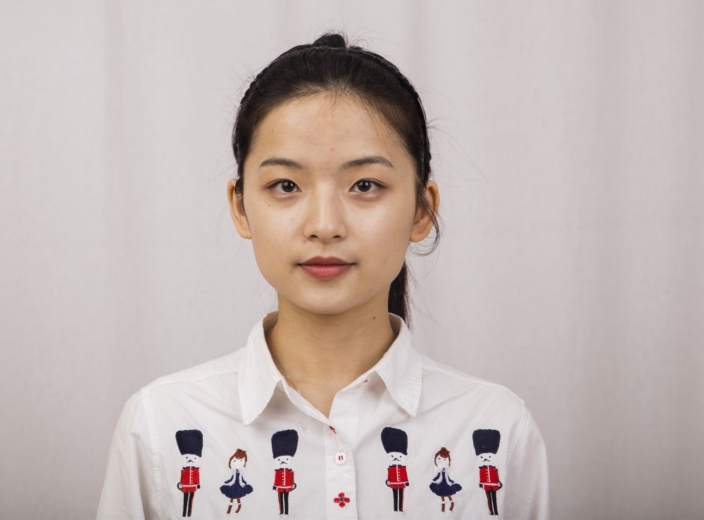 鄭州名門整形醫(yī)院董斌醫(yī)生做下頜角整形怎么樣？附下頜角整形案例
