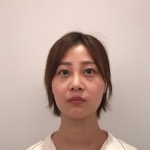 天津歐華威莎整形醫(yī)生姚玲做面部埋線提升效果怎么樣？附埋線提升案例