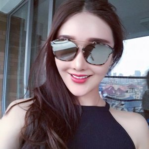 廣州柏德口腔蘭海龍醫(yī)生做瓷貼面效果怎么樣？廣州柏德口腔瓷貼面案例分享