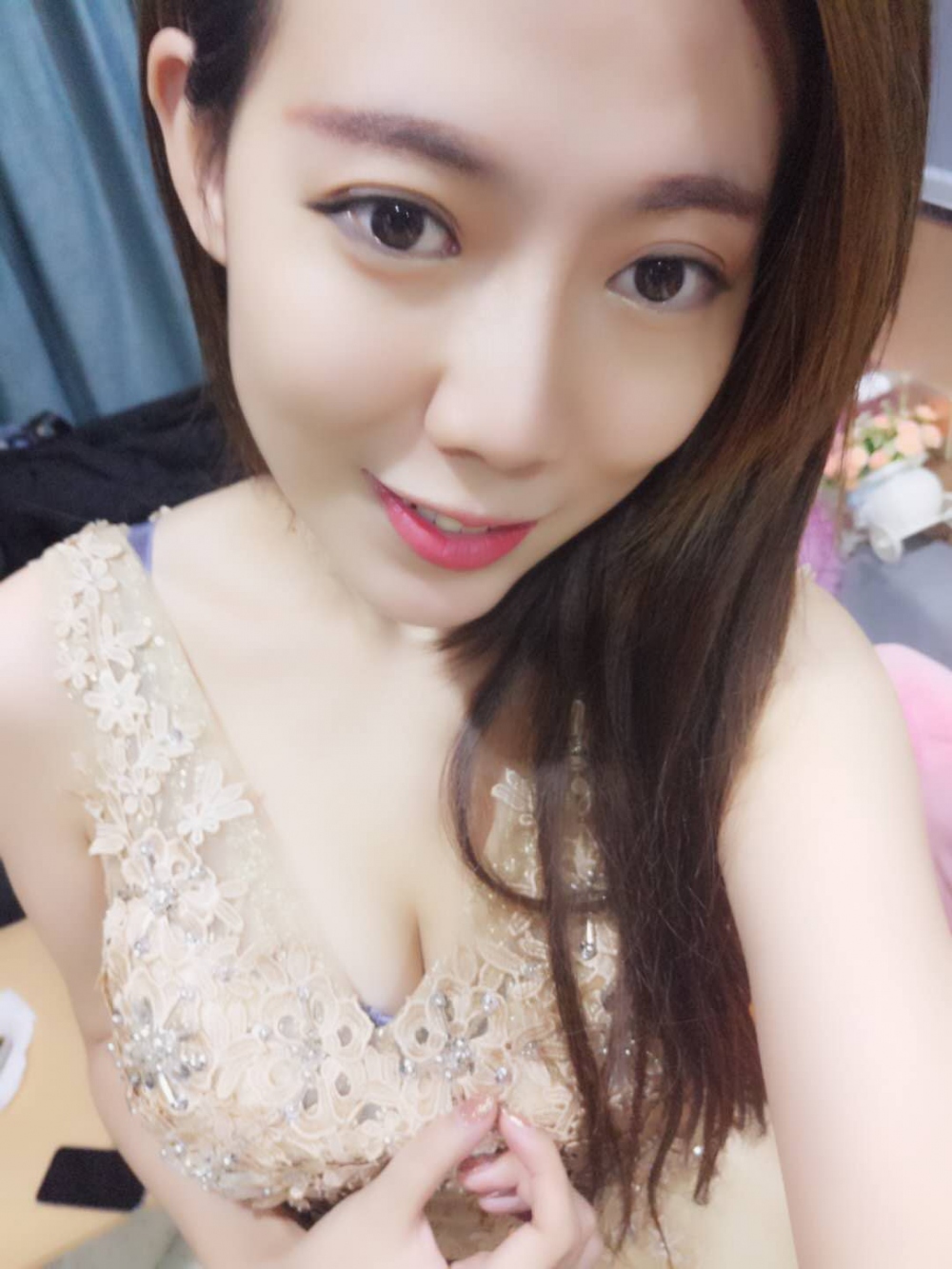 煙臺壹美整形醫(yī)院朱建瑩醫(yī)生做自體脂肪隆胸怎么樣？附自體脂肪隆胸案例