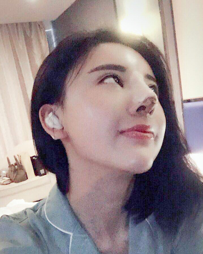 襄陽維多利亞整形醫(yī)院安邰晥醫(yī)生做鼻綜合整形怎么樣？附鼻綜合整形案例