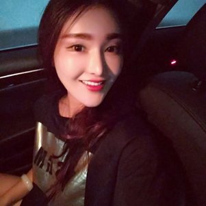 廣州柏德口腔蘭海龍醫(yī)生做瓷貼面效果怎么樣？廣州柏德口腔瓷貼面案例分享