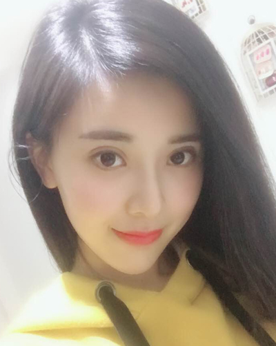 襄陽維多利亞整形醫(yī)院安邰晥醫(yī)生做鼻綜合整形怎么樣？附鼻綜合整形案例