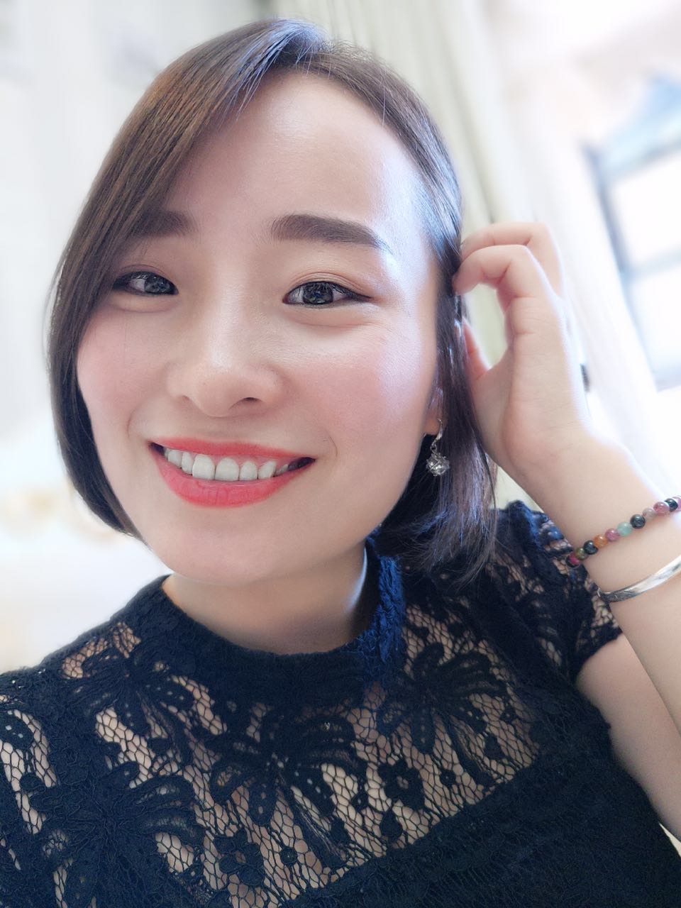 鄭州壹加壹整形醫(yī)院楊永利醫(yī)生做牙齒隱形矯正怎么樣？附牙齒隱形矯正案例