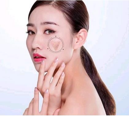 ?？诩t妝尚整形光子嫩膚