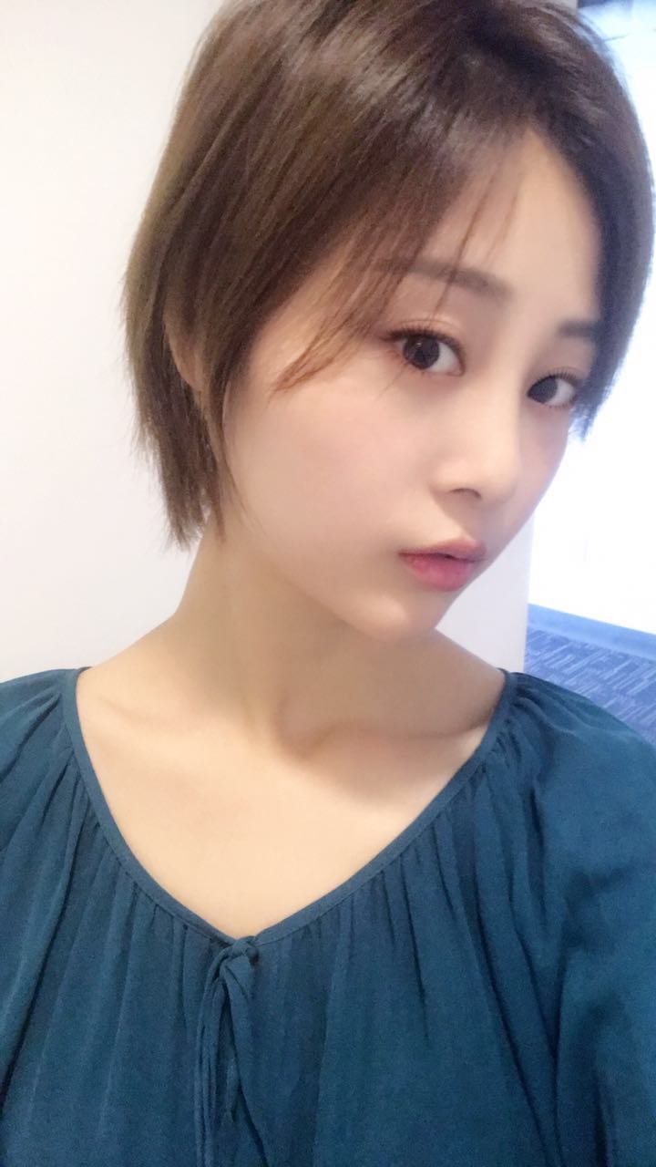 天津歐華威莎整形醫(yī)生姚玲做面部埋線提升效果怎么樣？附埋線提升案例