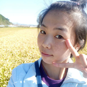珠海蒂伊醫(yī)療整形醫(yī)生廖俊凱做激光祛斑效果怎么樣？附激光祛斑案例效果圖