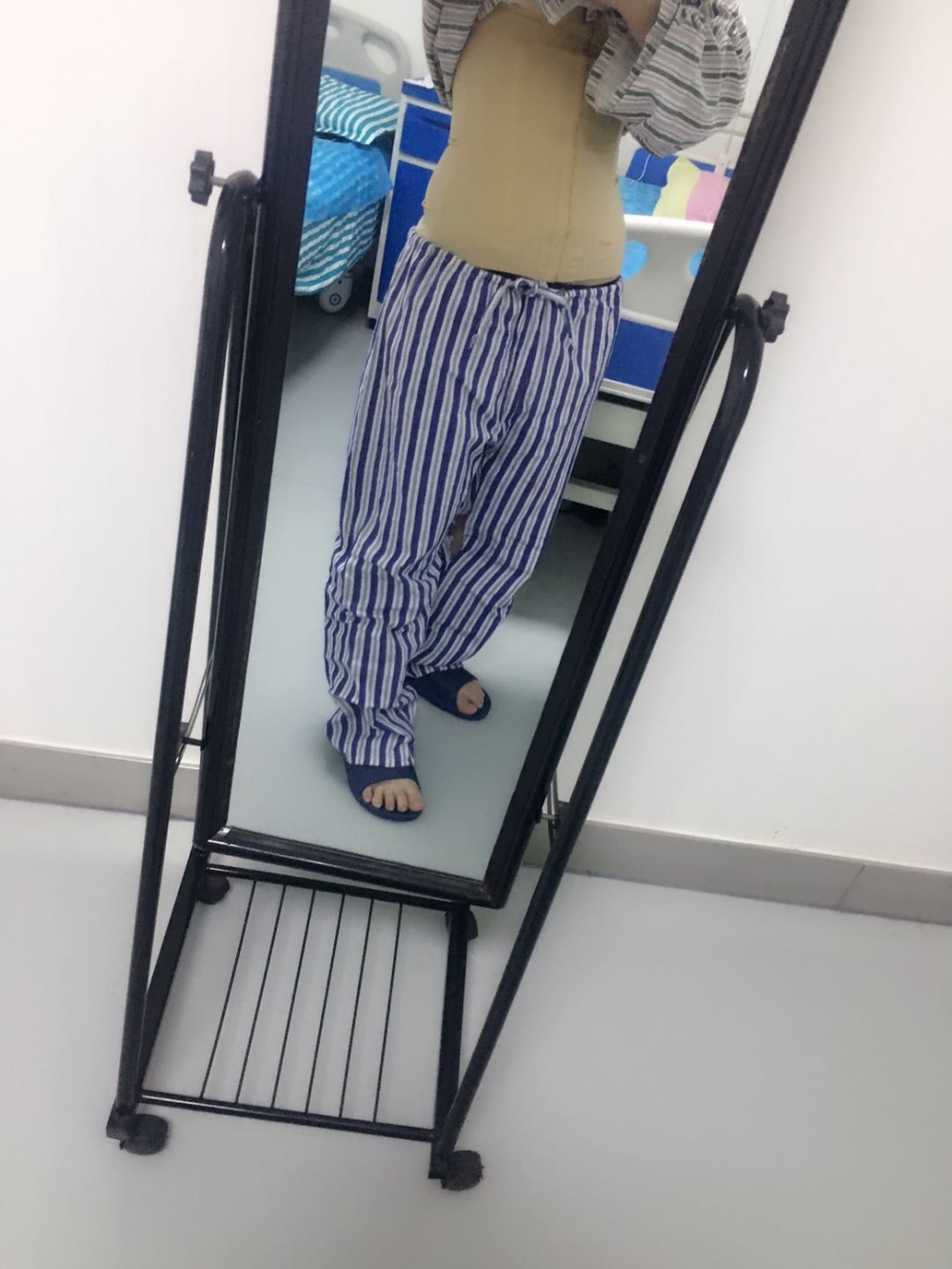 肇慶華美整形醫(yī)院陳巍醫(yī)生做腰腹吸脂效果怎么樣？附腰腹吸脂案例