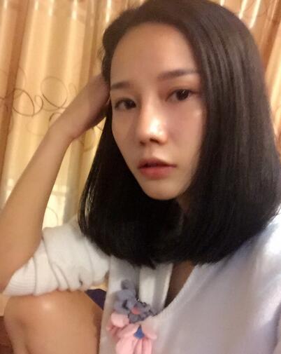 西安陽光整形醫(yī)院邵萍醫(yī)生做鼻綜合整形怎么樣？附鼻綜合整形案例