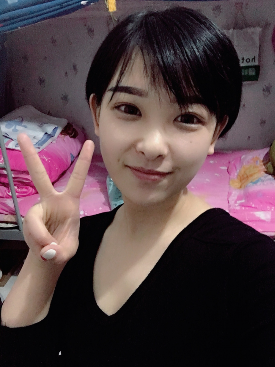 武漢肽慕醫(yī)美整形醫(yī)院楊婉菱醫(yī)生做面部吸脂效果怎么樣？附面部吸脂案例