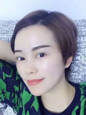 西安壹加壹整形醫(yī)院劉晨醫(yī)生做點(diǎn)陣激光祛痘效果怎么樣？附點(diǎn)陣激光祛痘效果圖