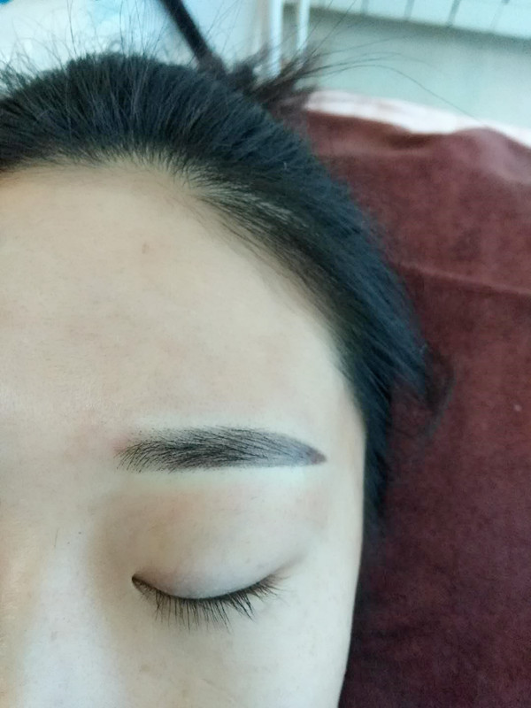 長(zhǎng)沙愛(ài)思特醫(yī)療美容醫(yī)院做半永久紋眉怎么樣？附彭子娟醫(yī)生案例效果圖