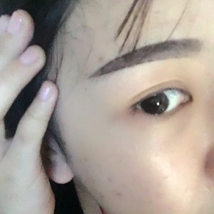 大同清木整形醫(yī)院張樹霞醫(yī)生做半永久紋眉效果如何？附半永久紋眉效果圖