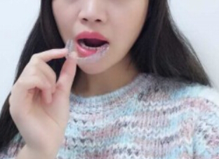 廈門拜博口腔醫(yī)院醫(yī)生張忠做牙齒隱形矯正怎么樣？附案例效果對比圖