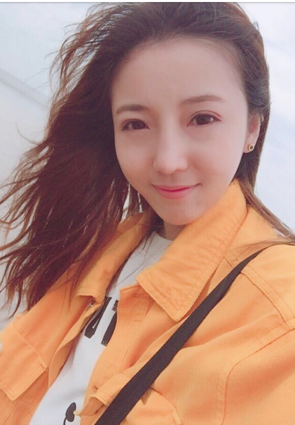 鄭州致美士整形醫(yī)院醫(yī)生閆江濤做鼻綜合+自體脂肪填充+吸脂案例效果對(duì)比圖