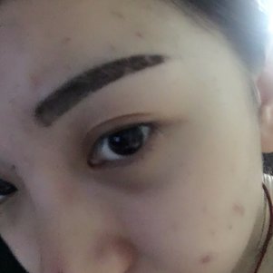 大同清木整形醫(yī)院張樹霞醫(yī)生做半永久紋眉效果如何？附半永久紋眉效果圖