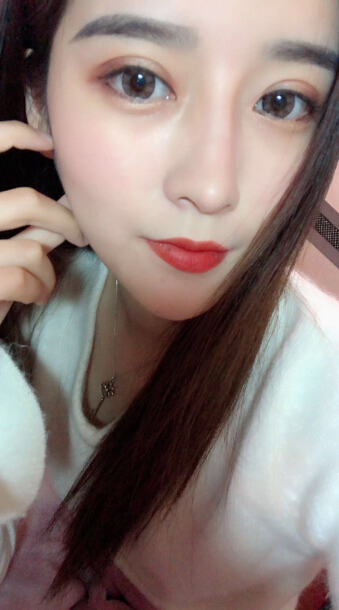 張家港唯恩整形醫(yī)院陳天杰醫(yī)生切開雙眼皮案例效果對比圖