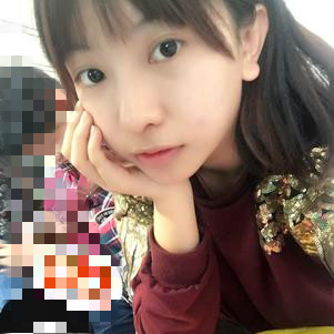 大同清木整形醫(yī)院張樹霞醫(yī)生做半永久紋眉效果如何？附半永久紋眉效果圖