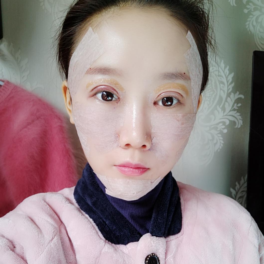 上海首爾麗格整形醫(yī)院醫(yī)生唐鏖做眼綜合+自體脂肪全臉填充案例效果對比圖