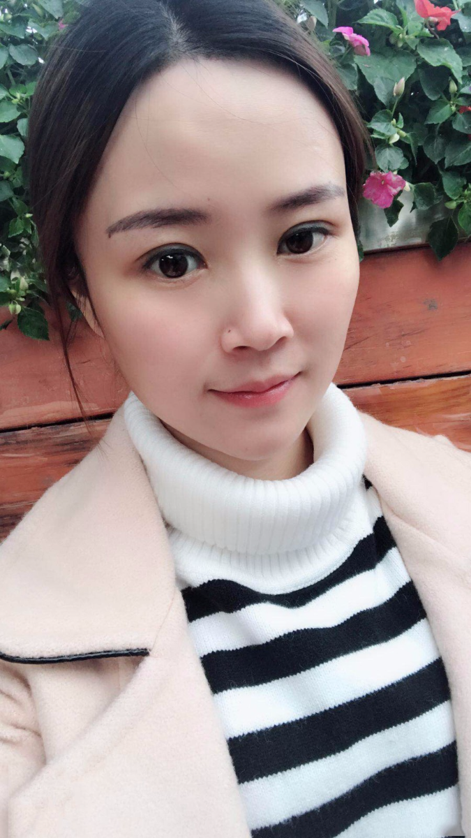 廣東韓妃醫(yī)療美容醫(yī)院做切開雙眼怎么樣？附案例效果圖