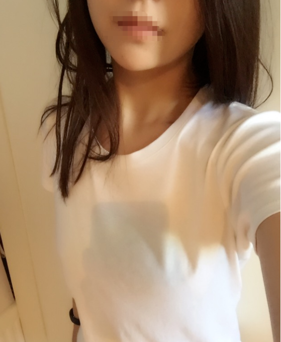 東莞韓美整形醫(yī)院醫(yī)生黃玉潔做假體隆胸怎么樣？附案例效果圖