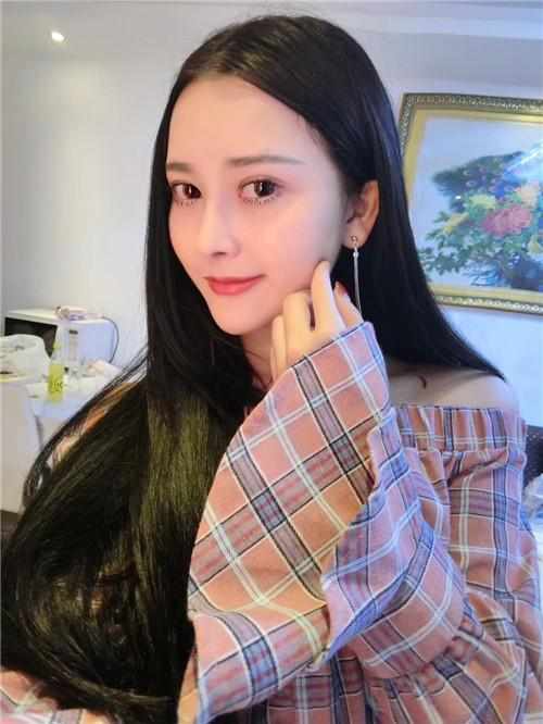 鄭州華領醫(yī)療美容醫(yī)院醫(yī)生張永濤做硅膠假體隆鼻怎么樣？附案例效果對比圖