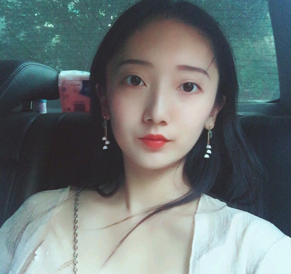 深圳鵬愛醫(yī)療美容醫(yī)院醫(yī)生文炯軫做埋線隆鼻怎么樣？附案例