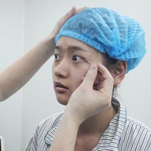 武漢伽美醫(yī)療美容醫(yī)院醫(yī)生鄭泰成做切開雙眼皮怎么樣？附案例