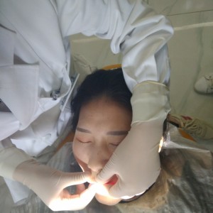 黔西南興義京州口腔醫(yī)院醫(yī)生徐勇做牙貼面怎么樣？附案例效果對(duì)比圖