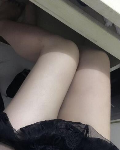 上海保加醫(yī)療美容門診部做大腿吸脂怎么樣？附楊勇醫(yī)生案例效果對比圖