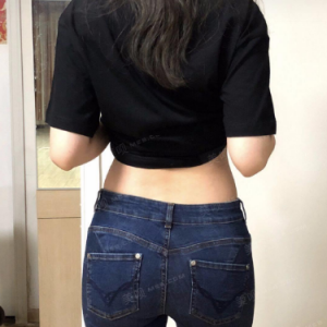 北京可思美整形醫(yī)院醫(yī)生斯勤做腰腹吸脂怎么樣？附案例效果對(duì)比圖