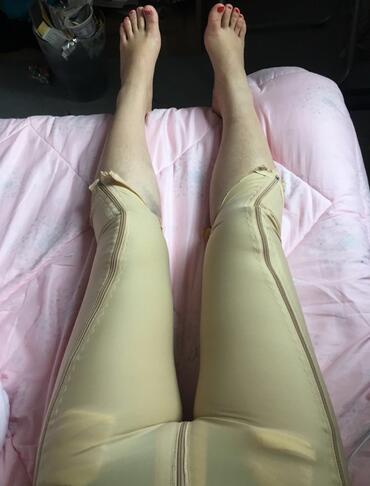 上海保加醫(yī)療美容門診部做大腿吸脂怎么樣？附楊勇醫(yī)生案例效果對比圖