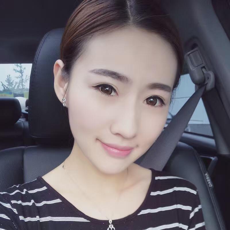 貴陽(yáng)美和諧醫(yī)療整形醫(yī)生孫澤芳做切開(kāi)雙眼皮效果怎么樣？附案例效果對(duì)比圖