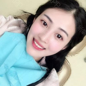 上?？仆呖谇会t(yī)院醫(yī)生鄧建儒做牙齒冷光美白怎么樣？附案例效果對(duì)比圖