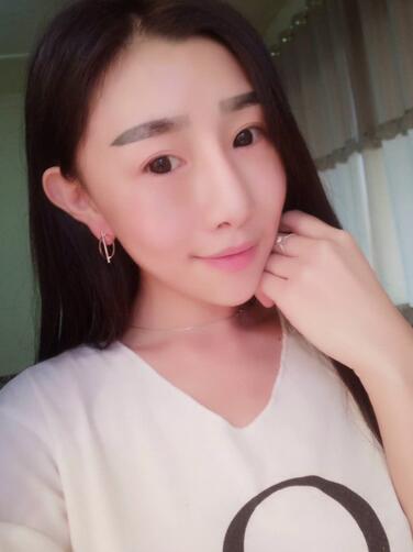 貴陽泰康樂醫(yī)院整形美容科醫(yī)生陳璐做自體脂肪全臉填充效果怎么樣？