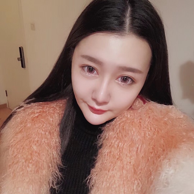 杭州格萊美整形美容醫(yī)院醫(yī)生張霞飛做自體脂肪全臉填充效果怎么樣？