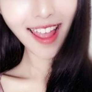 北京美年口腔醫(yī)院醫(yī)生劉海濤做牙齒冷光美白怎么樣？附案例效果對比圖