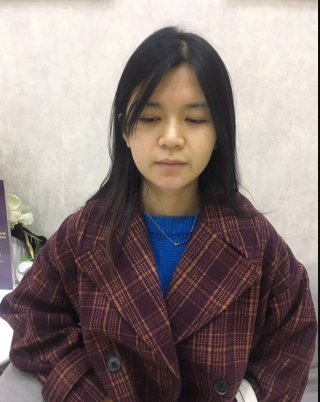 上海時(shí)光整形外科醫(yī)院醫(yī)生何晉龍做假體隆胸怎么樣？附案例效果對比圖
