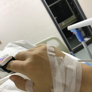 河南協(xié)和醫(yī)院整形外科醫(yī)生騰利做自體脂肪隆胸怎么樣？附案例效果對比圖
