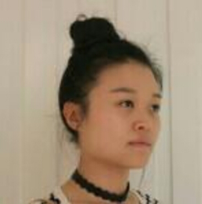 鄭州管城中醫(yī)院整形美容中心醫(yī)生張秀英做注射瘦臉怎么樣？附除皺瘦臉案例效果圖