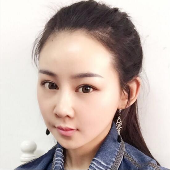 上海時(shí)光整形外科醫(yī)院醫(yī)生李靜林做假體隆鼻和反頜手術(shù)怎么樣？