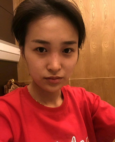 武漢米蘭醫(yī)療美容醫(yī)生柳再億做眼綜合+鼻綜合整形怎么樣？附真實(shí)案例對(duì)比圖