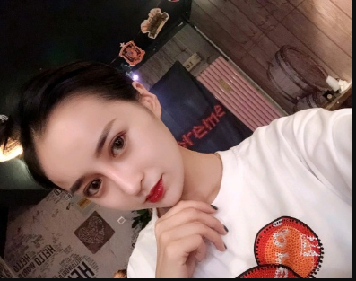 武漢米蘭醫(yī)療美容醫(yī)生柳再億做眼綜合+鼻綜合整形怎么樣？附真實(shí)案例對(duì)比圖