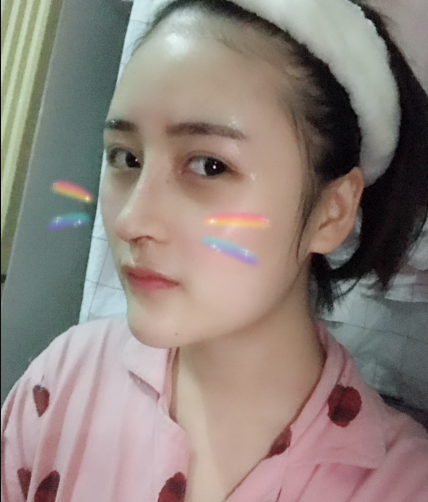 北京伊美爾美容愛(ài)康醫(yī)院醫(yī)生柳成做鼻綜合整形怎么樣？附案例效果圖
