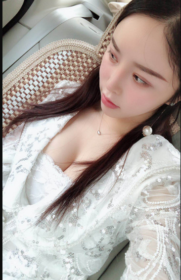 吉林現(xiàn)代整形美容醫(yī)院做假體隆胸效果怎么樣？附醫(yī)院案例效果對(duì)比圖