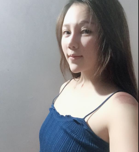 北京東方和諧醫(yī)療整形診所馮斌醫(yī)生做假體隆胸怎么樣？附案例效果對比圖