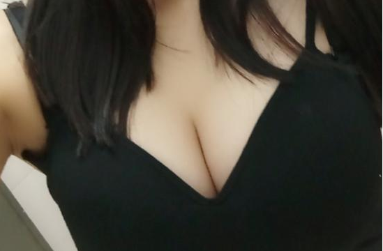 武漢伽美醫(yī)療美容醫(yī)院醫(yī)生朱富初做自體脂肪隆胸怎么樣？看案例