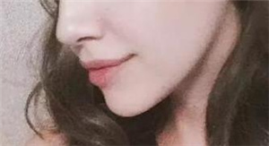 深圳陽光整形美容醫(yī)院隆鼻修復